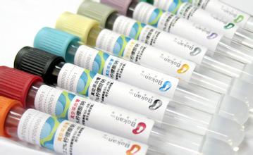 12月8号，，，，GA黄金甲被评为2011年度上海市优异手艺带动人