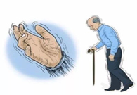 帕金森病，，，，，，“帕”不怕？？？