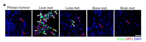 转入小鼠模子获得相同的试验效果，，，，且在转移爆发前NET已在肝脏聚积。。。。。。。