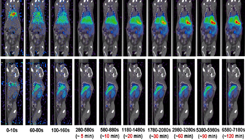 GA黄金甲PET/CT分子影像手艺平台