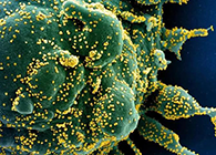 唾液检测新冠抗体新要领来了，，，，，，获取效果仅需几小时！