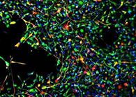 天下首创：药物将干细胞指导至受损部位，，，，，提高其愈合能力！