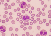 一种神秘颗粒被发明了！它能否成为败血症早筛标记物？？？？