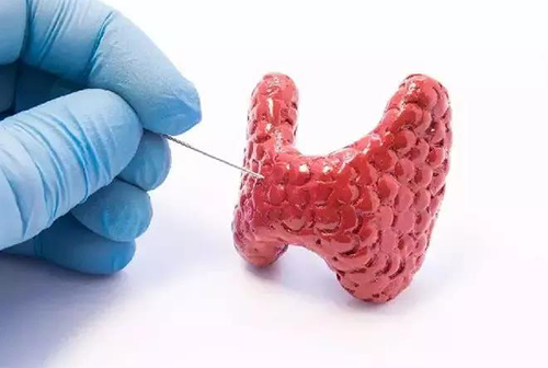 甲状腺疾病，，，，，包括甲状腺功效减退和甲状腺功效亢进，，，，，自古以来就是重复被医学研究职员研究的疾病