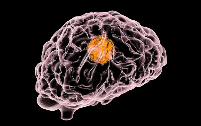 GA黄金甲助力 | 璧辰医药ABM-1310获美国FDA孤儿药资格认证，，，，用于治疗携带BRAF V600突变的脑胶质母细胞瘤患者